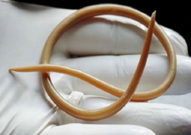 الدودة الأسطوانية تحدث تغييرات في جهاز المناعة لدى النساء، ما يجعله يتقبل الأجنة بصورة أفضل وفقا للدراسة الحديثة